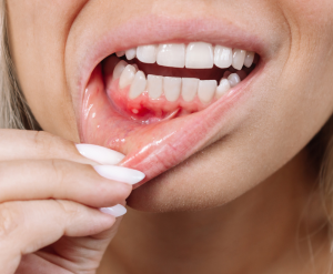 Maintains Gum Health